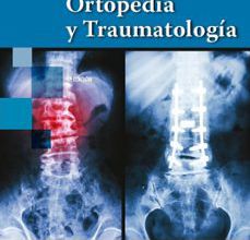 Las mejores descargas gratuitas de libros electrónicos en pdf ORTOPEDIA Y TRAUMATOLOGÍA 4 ED.