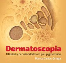 Descargar [PDF] {EPUB} DERMATOSCOPIA UTILIDAD Y PECULIARIDADES EN PIEL PIGMENTADA