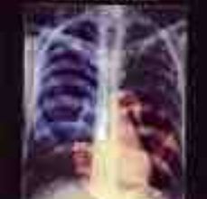 SQUIRE, FUNDAMENTOS DE RADIOLOGIA FRANK SQUIRE, ROBERT A. NOVELLINE ePub gratis