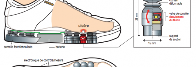 Diabète : une chaussure connectée pour éviter l'amputation