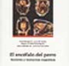 Descargar Ebook gratis para móvil EL ENCEFALO DEL PERRO: SECCIONES Y RESONANCIAS MAGNETICAS (INCLUY E CD) iBook 9788449022708