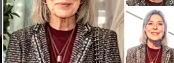Caroline de Monaco a eu recours à la chirurgie esthétique