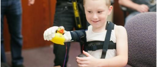 Une prothèse de bras réalisée par imprimante 3 D pour Alex !