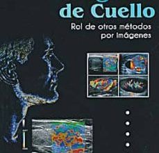 ECOGRAFIA DE CUELLO: ROL DE OTROS METODOS POR IMAGENES leer el libro