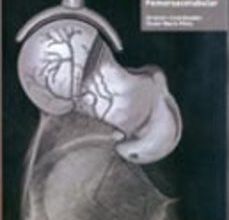 Ebook descargar gratis francés CHOQUE FEMOROACETABULAR 9788479789800