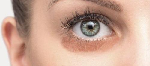 D'où viennent les cernes et pourquoi apparaissent-elles quand on est fatigué ?