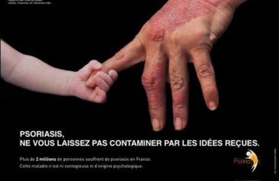 Psoriasis : stop aux idées reçues !