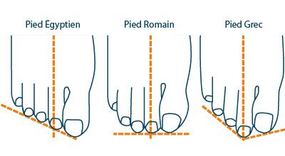 Pied égyptien, pied grec, ou pied romain ?