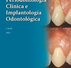 PERIODONTOLOGÍA CLÍNICA E IMPLANTOLOGÍA ODONTOLÓGICA TOMO 2 leer el libro