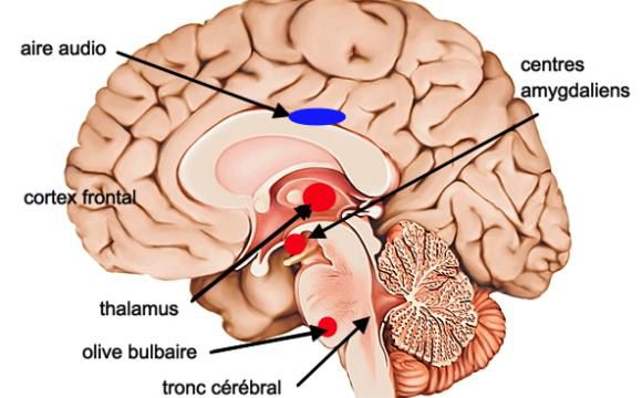 Les merveilles du centre auditif de notre cerveau.