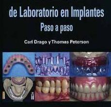[PDF] PROCEDIMIENTOS DE LABORATORIO EN IMPLANTES: PASO A PASO descargar gratis