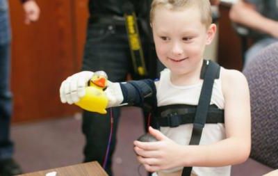 Une prothèse de bras réalisée par imprimante 3 D pour Alex !