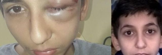 VITE UNE AUTRE FRANCE CELLE-CI N’EST PAS LA MIENNE !!!  Gabriel, 14 ans tabassé par les policiers !