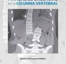 Descarga de la tienda de libros electrónicos Kindle MANUAL DE URGENCIAS EN LA COLUMNA VERTEBRAL (Literatura española) de IGNACIO DOMINGUEZ ESTEBAN RTF 9788417194420