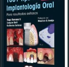 Descargar ebook 1001 TIPS EN IMPLANTOLOGIA ORAL PARA RESULTADOS EXITOSOS + VIDEOS ONLINE | Descarga Libros Gratis (PDF - EPUB)