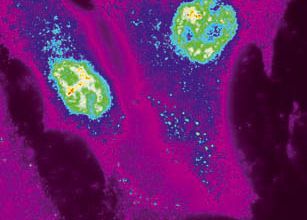 une nouvelle stratégie bactérienne pour contrôler l'immunité  