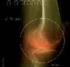 Gratis para descargar libros de audio COMO COMBATIR LA ARTROSIS FB2 ePub (Literatura española) de J. ARTIGAS GARCIA 9788497773959