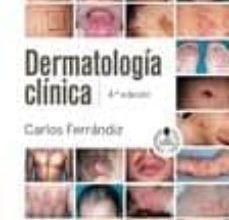 Leer libros en línea gratis sin descargar libros completos DERMATOLOGIA CLINICA (4ª ED.) (Spanish Edition)