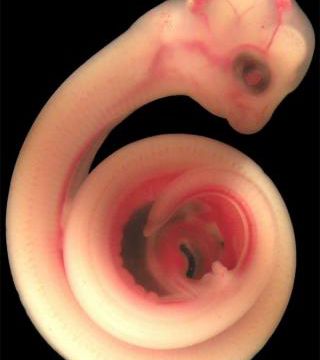 Des foetus d'animaux.
