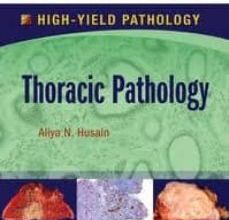 [PDF] THORACIC PATHOLOGY, A VOLUME IN THE HIGH YIELD PATHOLOGY descargar gratis