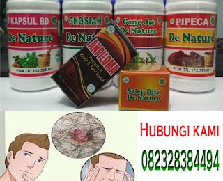 6 Pilihan Obat Herbal Untuk Menghilangkan Kutil Kelamin