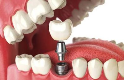 Diagnostic et thérapie en orthodontie dentaire