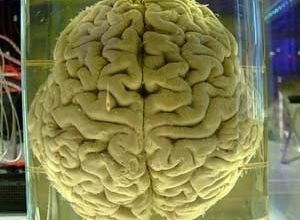 Comment devenir hypercon...