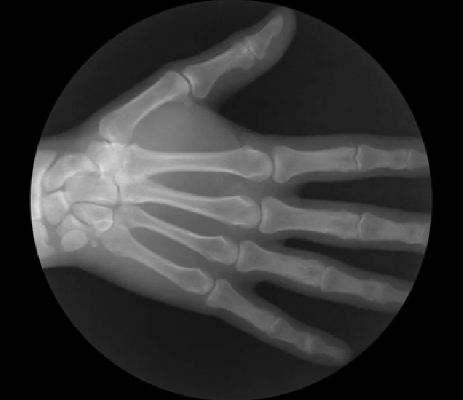 Articulations en Gif