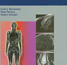 Descarga de libros electrónicos gratuitos para nook WHOLE BODY MR IMAGING 9783131358417