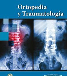 Descargas gratuitas para libros ORTOPEDIA Y TRAUMATOLOGÍA 4 ED. 9789500695541