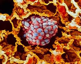 Cancer genomes reveal risks of sun and smoke