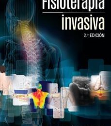 Descargar FISIOTERAPIA INVASIVA, 2ª ED F. VALERA Gratis - EPUB, PDF y MOBI