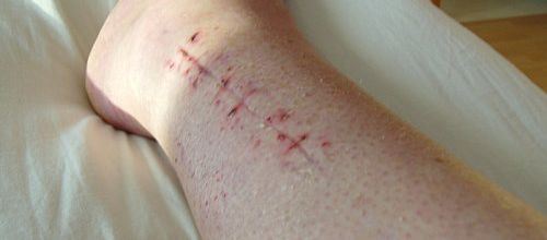 Débarrassée de ma botte de résine…. !!!!!