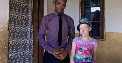 Le monde dangereux des albinos ... 
