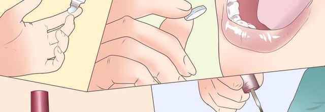 Comment traiter la mycose de l'ongle de l'orteil