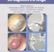 ATLAS A COLOR DE OTOSCOPIA: DEL DIAGNOSTICO A LA CIRUGIA leer pdf