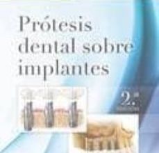 Descargando libros japoneses PRÓTESIS DENTAL SOBRE IMPLANTES, 2ª ED. (Spanish Edition) de C.E. MISCH 9788490228630