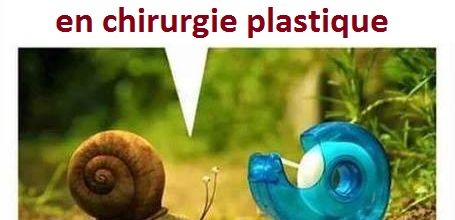 la plastique escargot