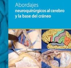 [PDF] ABORDAJES NEUROQUIRURGICOS AL CEREBRO Y A LA BASE DEL CRANEO descargar gratis