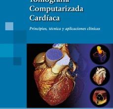 TOMOGRAFIA COMPUTARIZADA CARDIACA: PRINCIPIOS, TECNICA Y APLICACIONES CLINICAS leer epub gratis