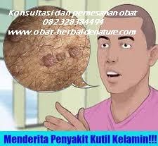 4 Nama Obat Kutil Kelamin De Nature