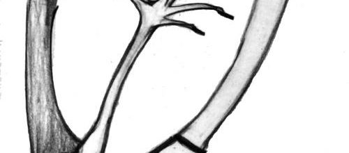 Talons aiguilles, botox et autres victimes de la mode ...