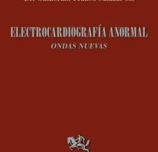 Descargar ebook ELECTROCARDIOGRAFIA ANORMAL | Descarga Libros Gratis (PDF - EPUB)