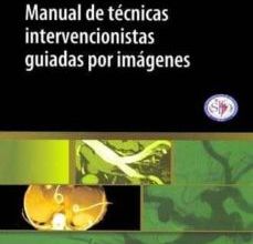 Descargar [PDF] {EPUB} MANUAL DE TECNICAS INTERVENCIONISTAS GUIADAS POR IMAGENES