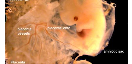 gross structure of the embryo, its membranes and the developing placenta.