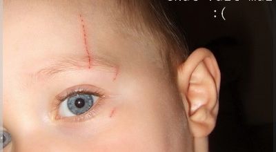 Chat fait mal ... :s