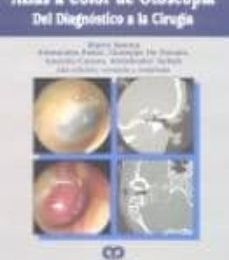 ATLAS A COLOR DE OTOSCOPIA: DEL DIAGNOSTICO A LA CIRUGIA leer pdf