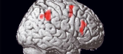L'hypnose n'est pas de la magie