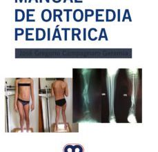 [Kindle] MANUAL DE ORTOPEDIA PEDIATRICA descargar gratis