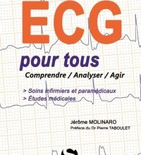 Téléchargez le pdf ebook ECG pour tous  - Comprendre, analyser, agir PDB RTF in French 9782356401977